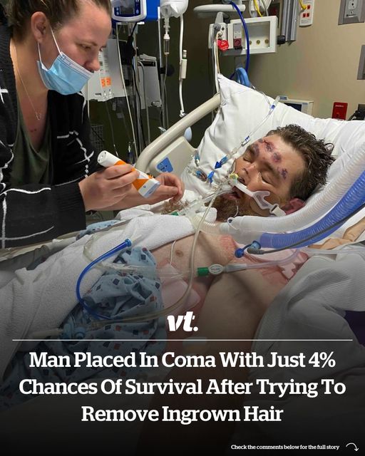 Man placed in coma with just 4% chances of survival after trying to remove ingrown hair