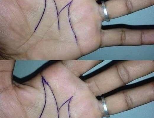 The Mystery of the “M” on Your Palm