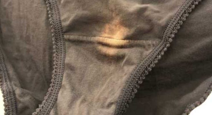 If you find a “bleach” patch on your underwear, you’d better know what it means